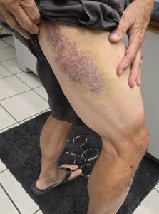 Full body contact at 24 mph